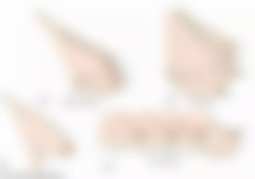 五、治疗成效对比图片展示