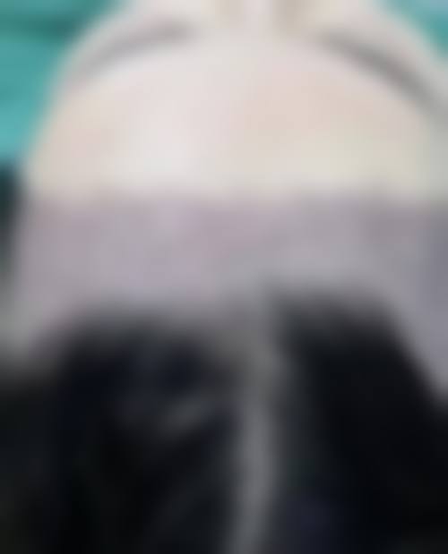 六、李猛真实的患者评价