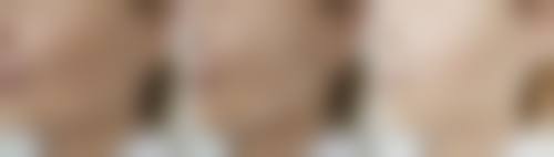 六、解放军第二炮兵总医院激光整形外科价格表