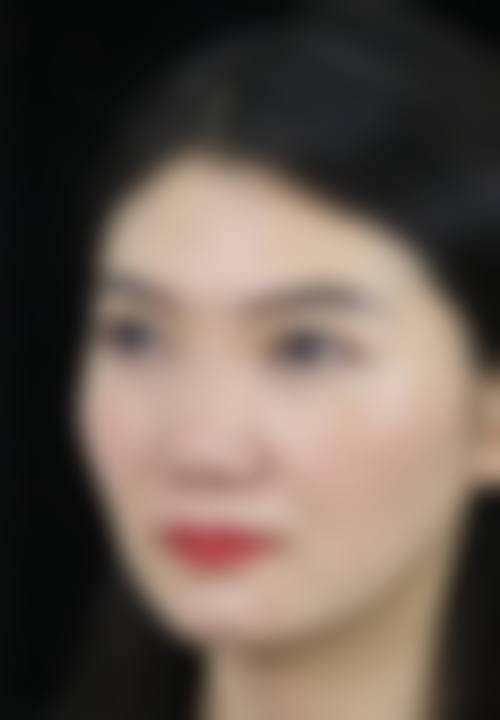 二、解放军第二炮兵总医院激光整形外科怎么样？