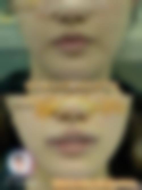 八、解放军第二炮兵总医院激光整形外科预约方式