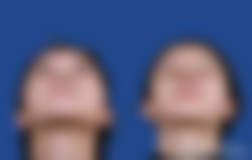 二、厦门建国整形外科门诊部怎么样？