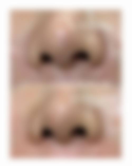 九、黑龙江哈尔滨博士蜜柚整形医院真实的患者评价