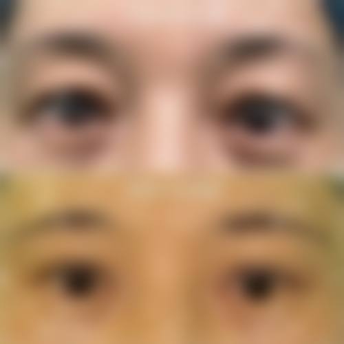 七、阳泉煤业集团总医院整形美容科地址及交通