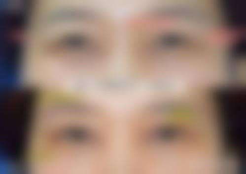 九、阳泉煤业集团总医院整形美容科真实的患者评价