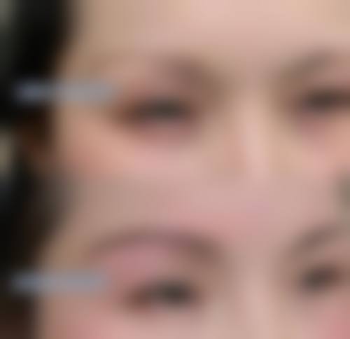 六、阳泉煤业集团总医院整形美容科价格表