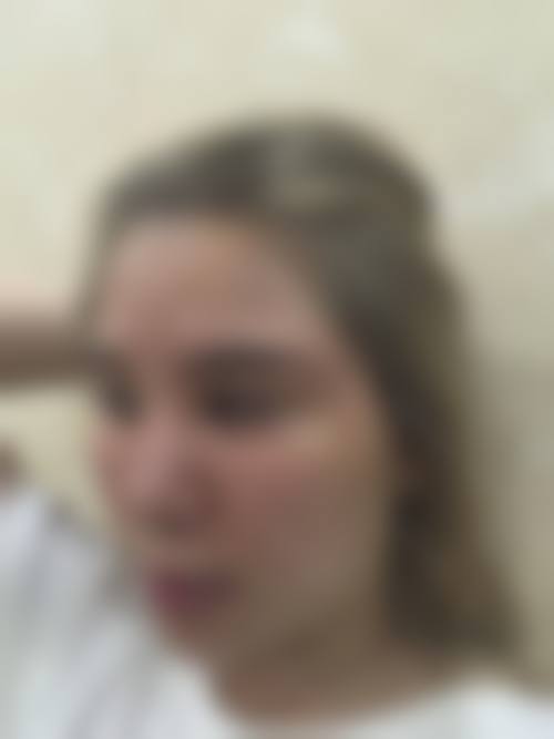 四、江山控颜时代整形医院特色项目