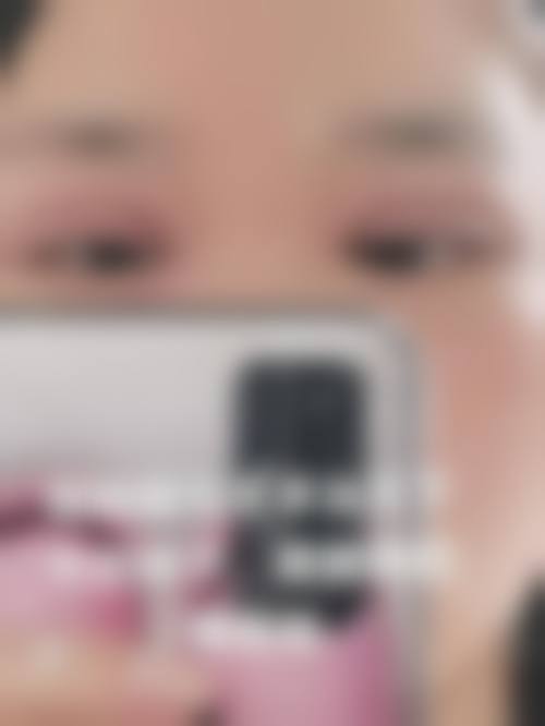 三、解放军第二炮兵总医院激光整形外科诊疗项目有哪些？