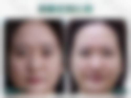 四、阳泉煤业集团总医院整形美容科特色项目