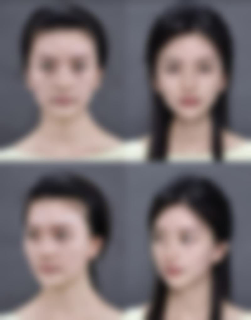 {疙瘩疤痕增生怎么去除？多种方法揭秘并有去除前后对比图片为你呈现效果！ 