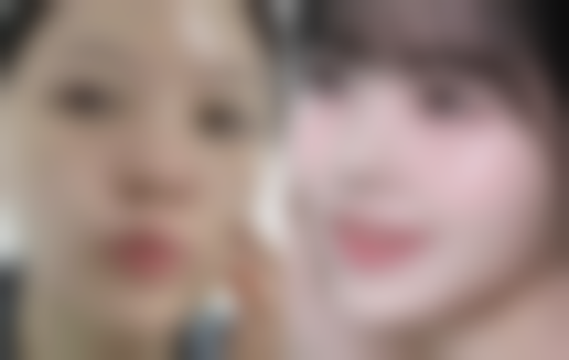 {40岁女性还可以隆胸吗？满足条件就能重塑身材曲线提升自信！ 