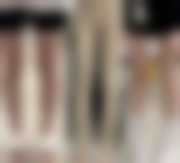 {达拉斯隆鼻的材料是什么？硅胶、膨体、自体与异体肋软骨及超肋材料大揭秘 