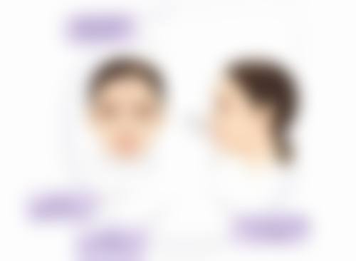 四、隆鼻会有什么后遗症之后遗症的应对方法