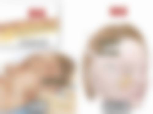 {脸上的旧凹陷疤痕怎么修复？多种方法助你有效去掉旧凹疤重焕肌肤光彩 