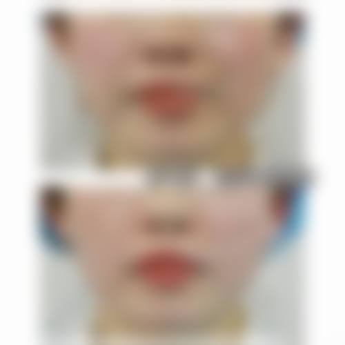 六、广州轻伊美速颜整形医院地址及交通