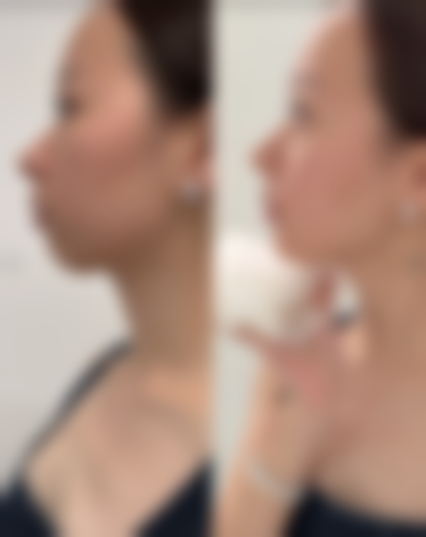 三、江苏省中医院(整形外科(医疗美容科))诊疗项目有哪些？