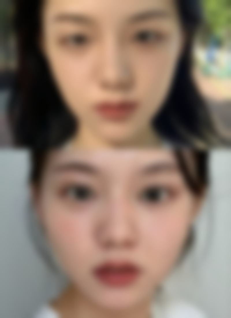 九、韩国佳轮韩整形外科真实的患者评价