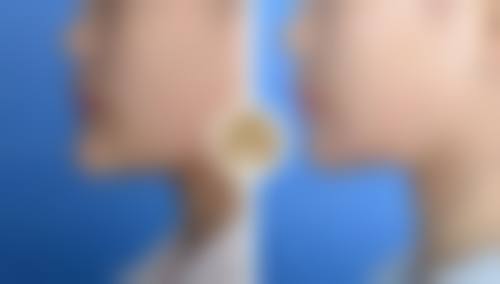 一、阴道紧缩术后成效的维持机制是啥样