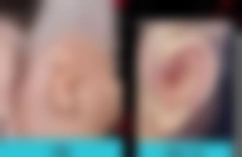 三、如何延长阴道紧缩术后的成效