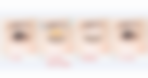 三、去眼袋后的修复阶段