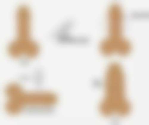 三、疤痕发红与疤痕增生