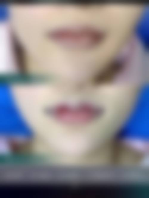 五、长沙敦诗邑整形医院价格表