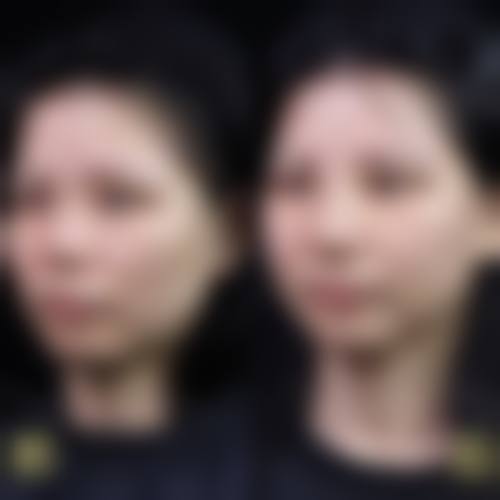 五、巢湖市前列人民医院烧伤整形科价格表