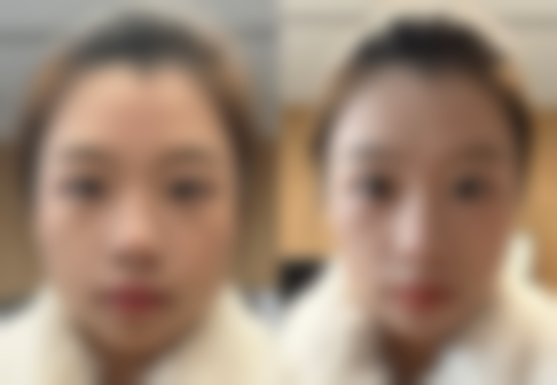 五、宝鸡美瑞拉医疗美容诊所价格表