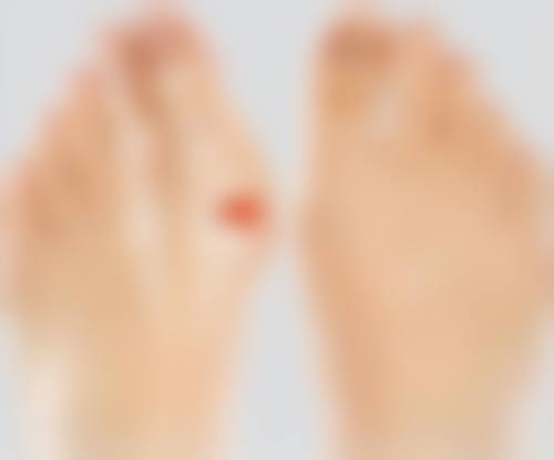 双眼皮内眼角可以修复吗？