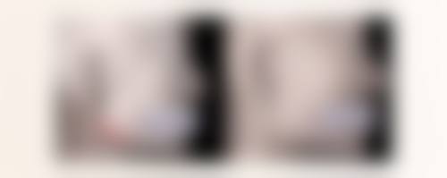 一、无痕去眼袋的基本概念