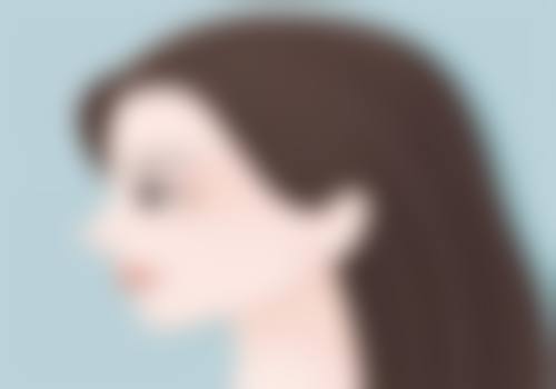 三、怎么能治疤痕增生之物理疗法