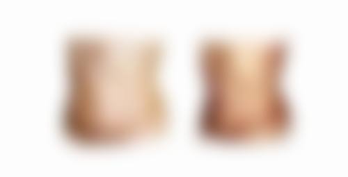 {怎么能治疤痕增生？药物、手术、物理疗法等多种方法为你解难题 