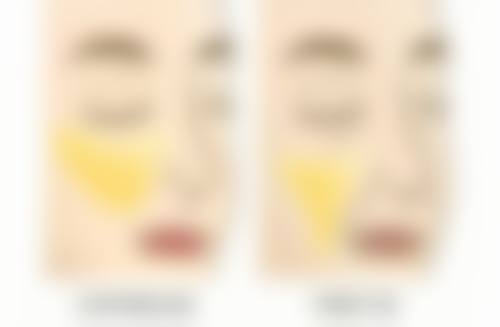 三、无痕去眼袋的见效时间