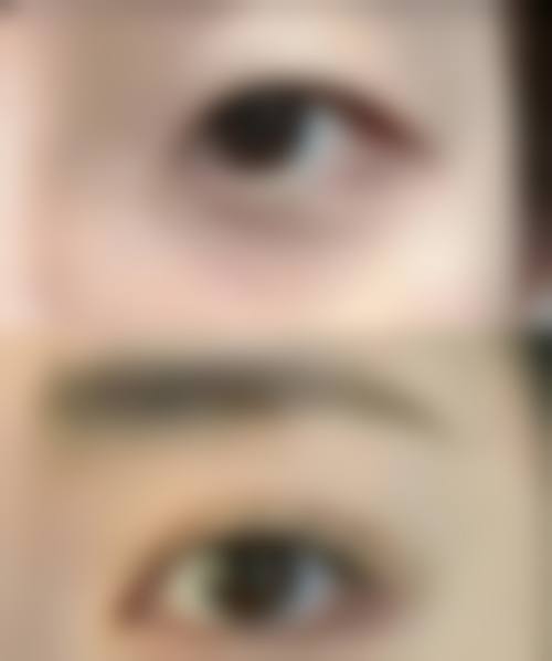 四、重庆依雪时尚医疗美容门诊部特色项目