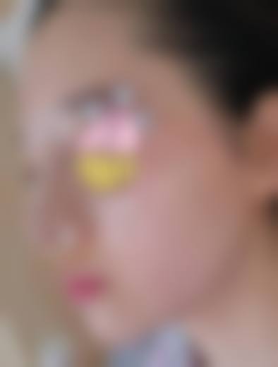 七、临沂市人民医院(烧伤整形外科)预约方式