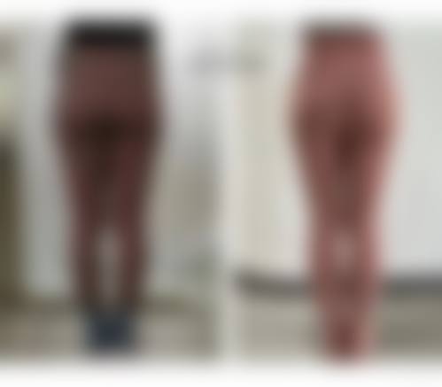 八、Roi整形外科真实的患者评价