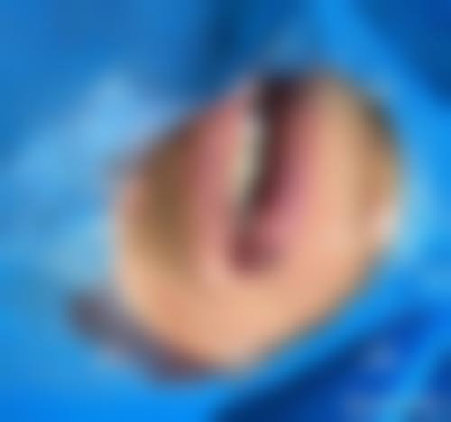 二、山东省交通医院烧伤整形外科怎么样？