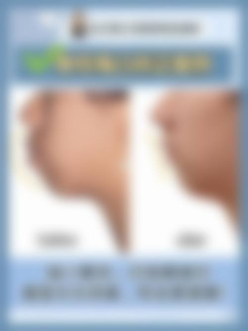 八、临沂市人民医院(烧伤整形外科)真实的患者评价