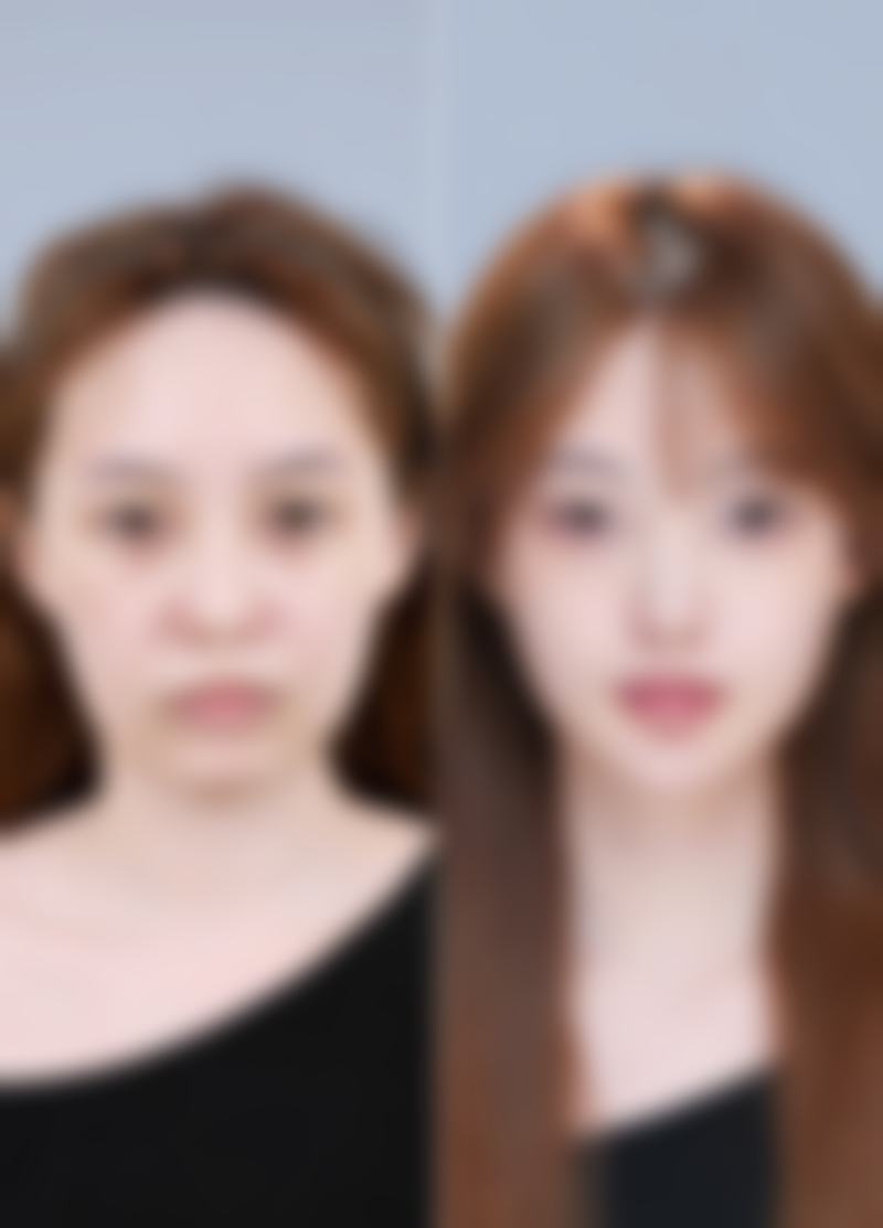 三、金进技术优势