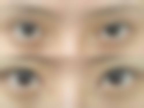 九、大同艾菲尔医疗美容真实的患者评价