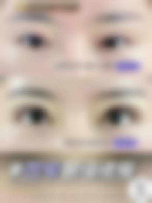 四、大同艾菲尔医疗美容特色项目