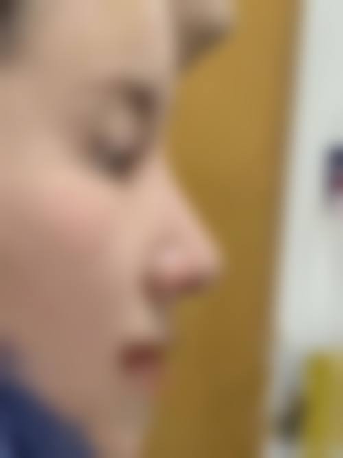 六、镇江京口康美整形价格表