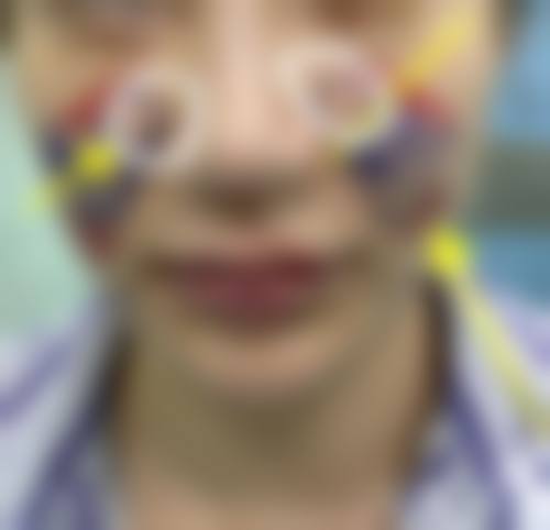 九、镇江京口康美整形真实的患者评价