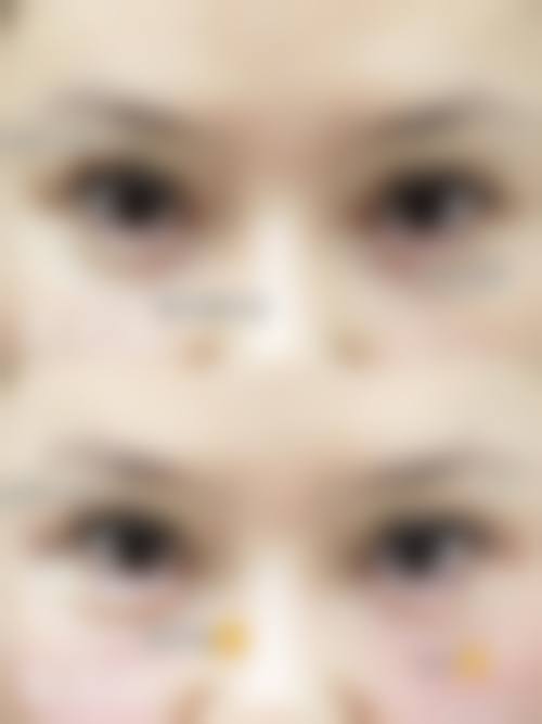 二、北京青柠医疗美容怎么样？