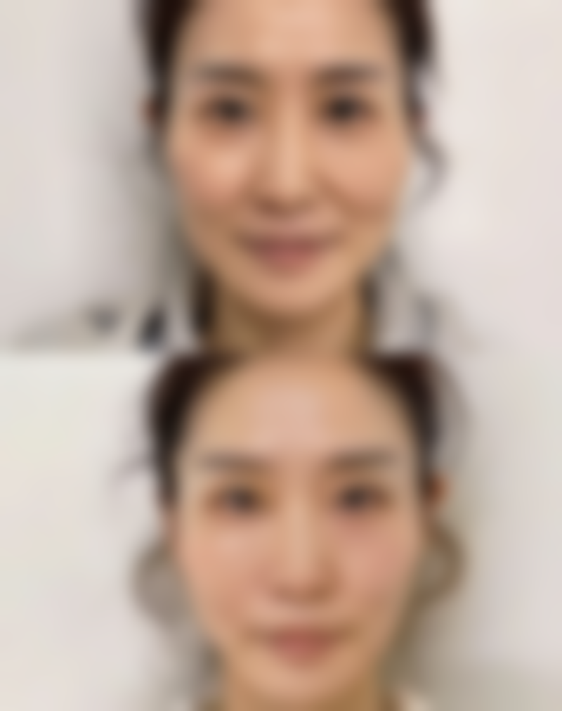 三、怎样去掉熬夜眼袋之使用眼霜