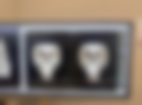 二、怎么消眼袋成效好之物理治疗