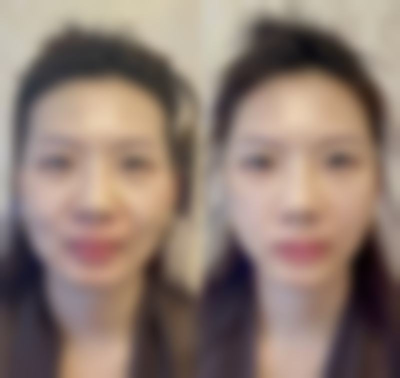 一、怎样去掉熬夜眼袋之避免熬夜和睡前饮水