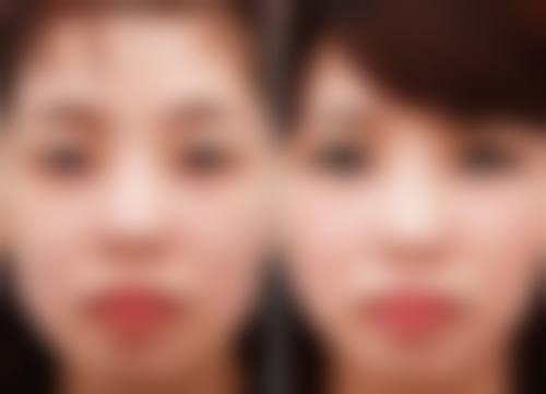 八、乌鲁木齐平修琳医疗美容诊所真实的患者评价