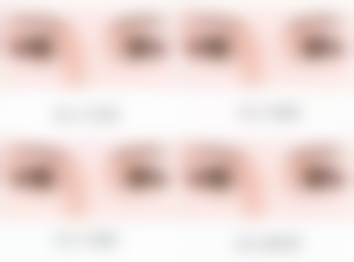 {儿童疤痕越早做激光越好吗？带你了解儿童凹陷疤痕能否慢慢长平 