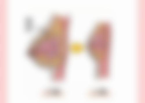 一、儿童疤痕激光治疗的基本情况